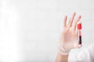 private blood tests